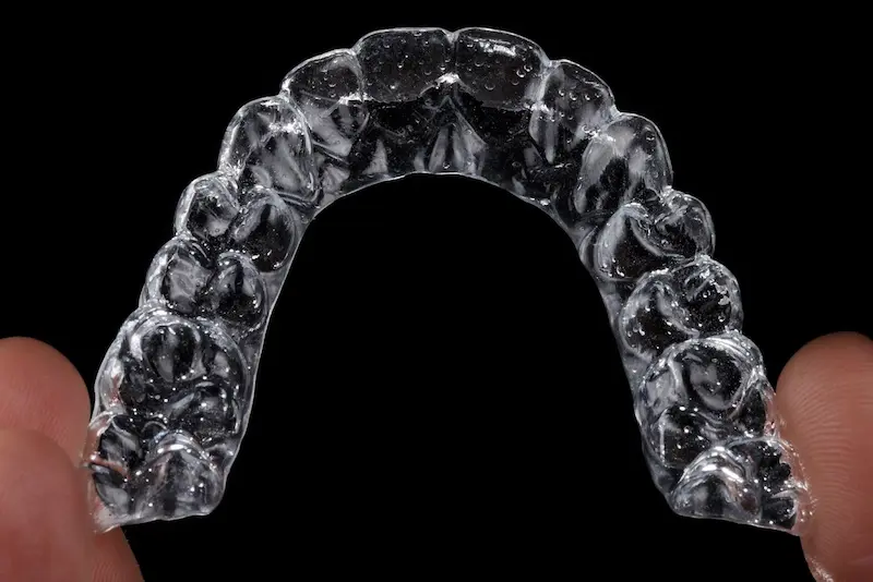 Customized Treatment Plan For Dental Aligners